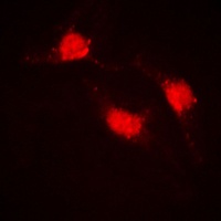 Beta-catenin Rabbit Polyclonal Antibody