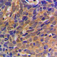 Beta-catenin Rabbit Polyclonal Antibody
