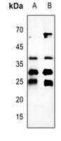 Cathepsin B Antibody