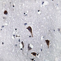 Cathepsin B Antibody