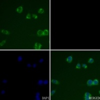 Cathepsin B Antibody
