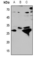 Cathepsin D Rabbit Polyclonal Antibody