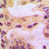 Cathepsin D Rabbit Polyclonal Antibody