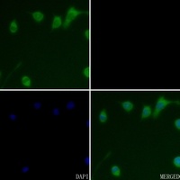 Cathepsin D Rabbit Polyclonal Antibody