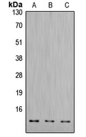 Cathepsin D LC Rabbit Polyclonal Antibody