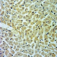 Cathepsin D LC Rabbit Polyclonal Antibody