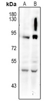 gp91 phox Rabbit Polyclonal Antibody