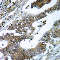gp91 phox Rabbit Polyclonal Antibody