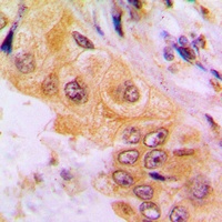 Cytochrome P450 2A7 Rabbit Polyclonal Antibody