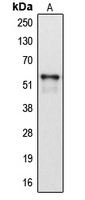 Cytochrome P450 2A6 Rabbit Polyclonal Antibody