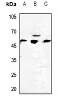 Cytochrome P450 2D6 Rabbit Polyclonal Antibody