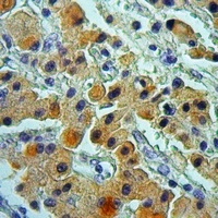 Cytochrome P450 2D6 Rabbit Polyclonal Antibody