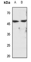 Cytochrome P450 2D6 Rabbit Polyclonal Antibody