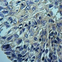 Cytochrome P450 2D6 Rabbit Polyclonal Antibody