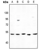 Cytochrome P450 2D6 Rabbit Polyclonal Antibody