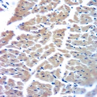 Cytochrome P450 2D6 Rabbit Polyclonal Antibody