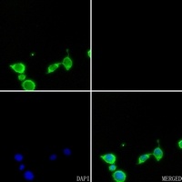 Cytochrome P450 2D6 Rabbit Polyclonal Antibody