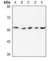 Cytochrome P450 2E1 Rabbit Polyclonal Antibody