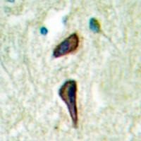 Cytochrome P450 2E1 Rabbit Polyclonal Antibody