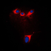 Cytochrome P450 2E1 Rabbit Polyclonal Antibody