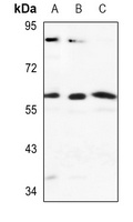 Cytochrome P450 2J2 Rabbit Polyclonal Antibody