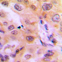 Cytochrome P450 2J2 Rabbit Polyclonal Antibody