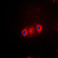 Cytochrome P450 2J2 Rabbit Polyclonal Antibody