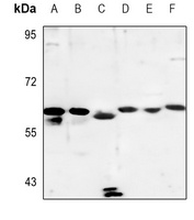 Cytochrome P450 4A11/22 Rabbit Polyclonal Antibody