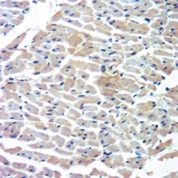 Cytochrome P450 4A11/22 Rabbit Polyclonal Antibody
