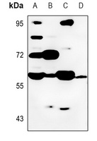 Cytochrome P450 8B1 Rabbit Polyclonal Antibody