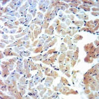 Cytochrome P450 11A1 Rabbit Polyclonal Antibody
