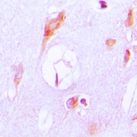 Cytochrome P450 27A1 Antibody