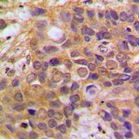 DAXX Rabbit Polyclonal Antibody