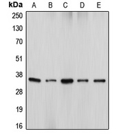 DFF45 Rabbit Polyclonal Antibody