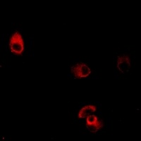 Dopamine Receptor D4 Rabbit Polyclonal Antibody