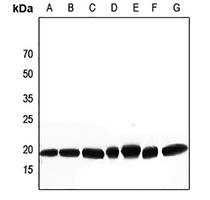 DSCR1 Antibody