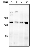 Desmoglein 3 Rabbit Polyclonal Antibody
