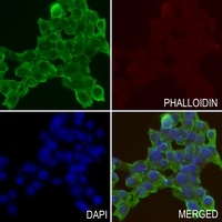 Desmoglein 3 Rabbit Polyclonal Antibody