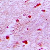 E2F2 Rabbit Polyclonal Antibody