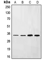 Ephrin B3 Rabbit Polyclonal Antibody