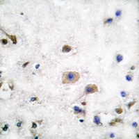 Ephrin B3 Rabbit Polyclonal Antibody