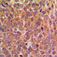 EIF2S1 (Phospho-S51) Rabbit Polyclonal Antibody