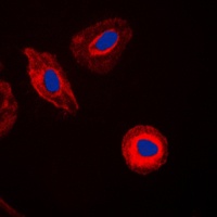 EIF4G2 Rabbit Polyclonal Antibody