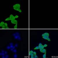 EIF5A Rabbit Polyclonal Antibody