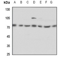 ELF4 Rabbit Polyclonal Antibody
