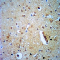 ELF4 Rabbit Polyclonal Antibody