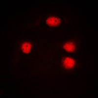 ELF5 Rabbit Polyclonal Antibody