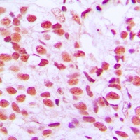ELK1 (Phospho-S389) Antibody