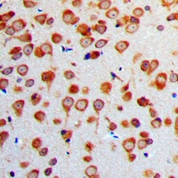 Gamma-enolase Antibody