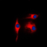 Gamma-enolase Antibody